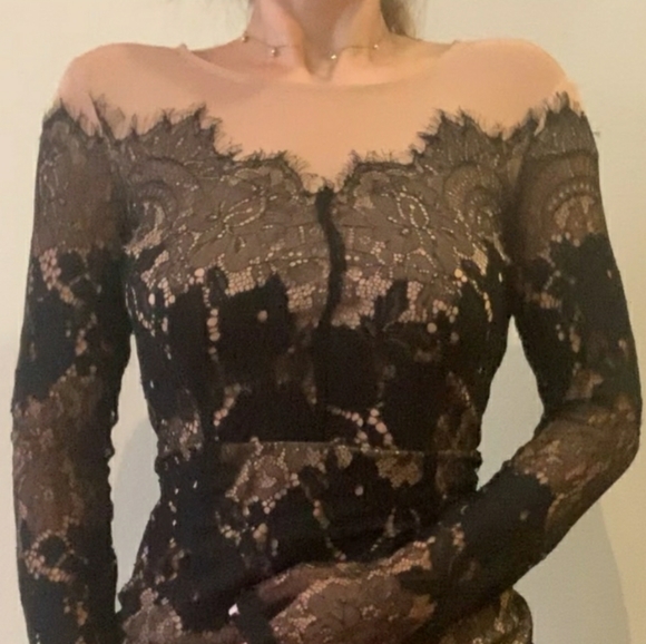 Lace dress - Picture 2 of 3